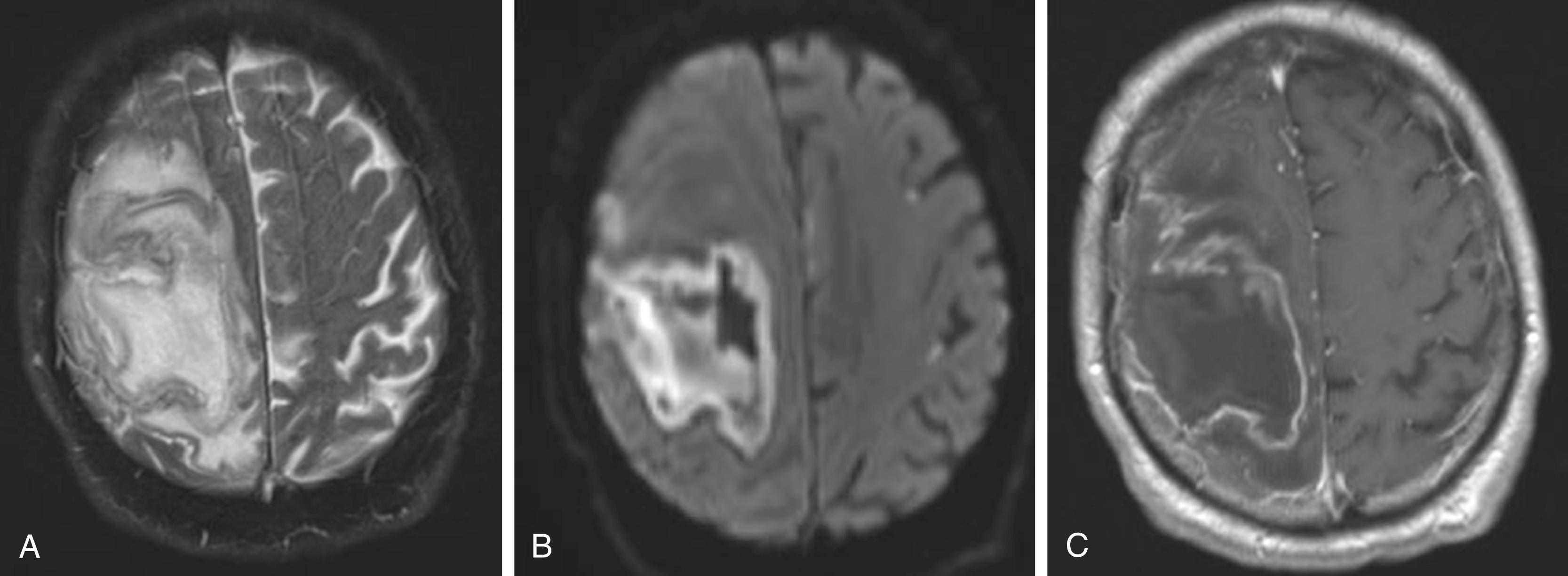 Figure 56.3, Day 14 after detection.