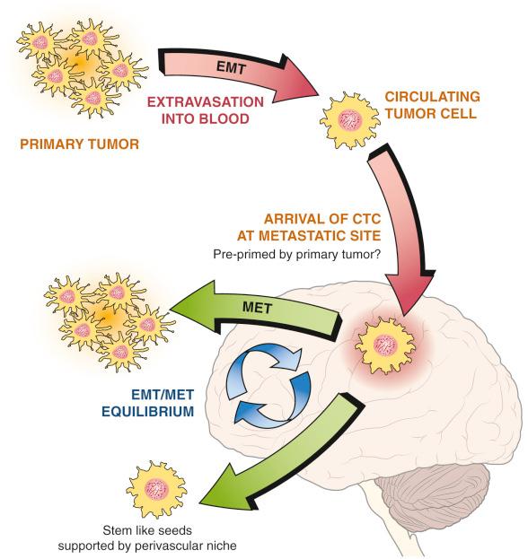 Figure 40.1, Seed-and-soil hypothesis for metastasis to the brain. 6 Primary cancer cells must enter the systemic bloodstream, arrest in a capillary bed within the brain, cross the blood-brain barrier, and survive interaction with astrocytes and microglia during implantation and proliferation. This process is hypothesized to involve transition to and from a “mesenchymal” state; the epithelial to mesenchymal transition (EMT) allows transition into the bloodstream and avoidance of anchorage-independent cell death, whereas the reverse mesenchymal-to-epithelial transition (MET) promotes conversion back to parent cell morphology and growth of metastases in the target organ.