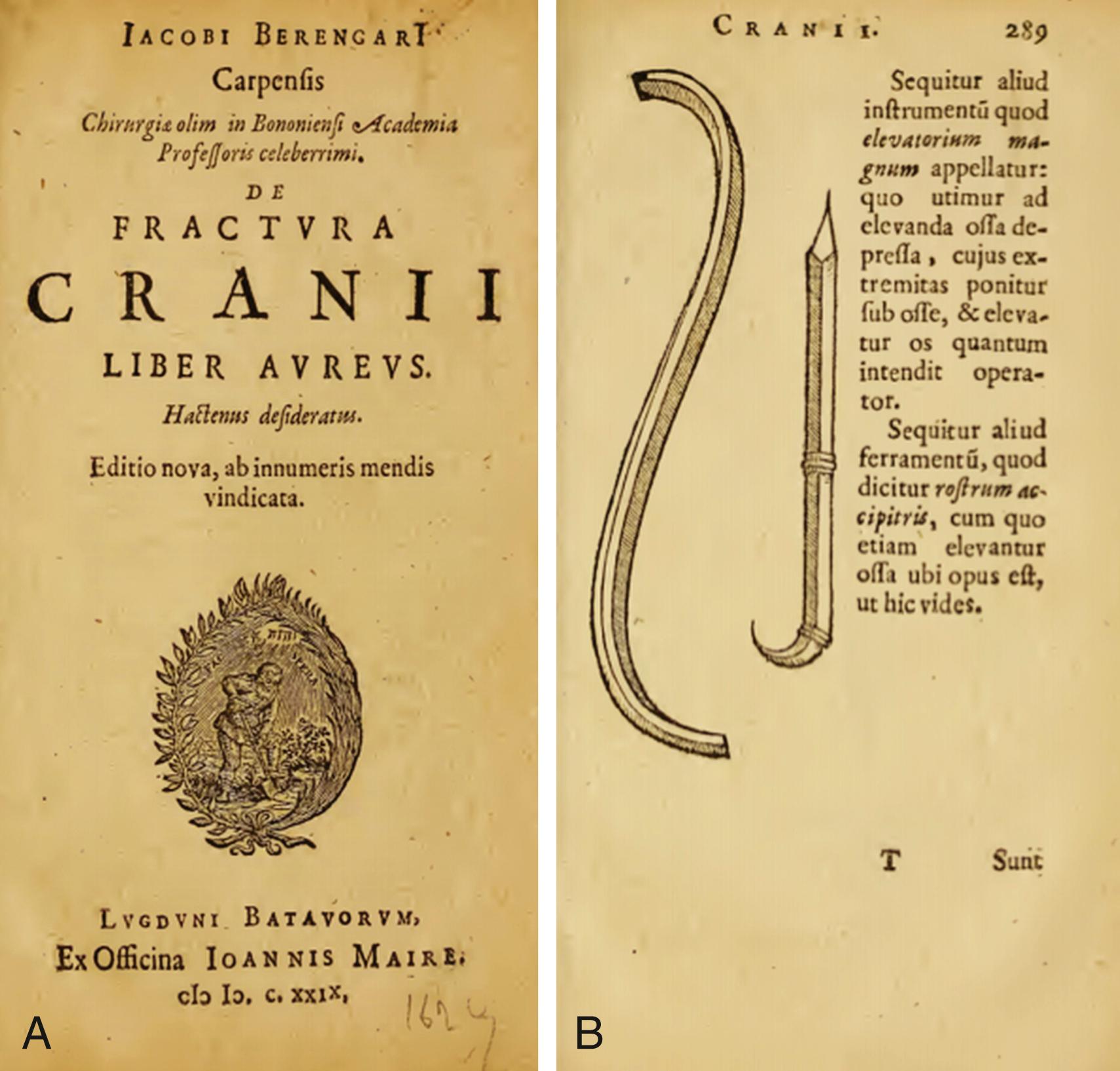 eFigure 33.1, (A) Berengario da Carpi on Fracture of the Skull or Cranium, 1629. His writings were paramount to the popularization of cranial surgery, and his work includes illustrations of instructions for the procedure of craniotomy for treatment of skull fractures, along with drawings of surgical instruments. (B) Illustration of brain elevators used by Berengario da Carpi in his surgical techniques.