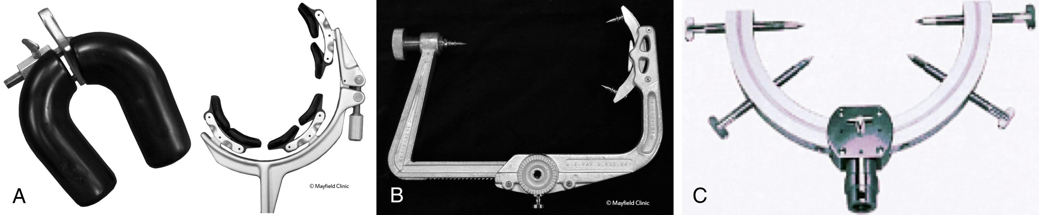 eFigure 33.11, The most commonly used neurosurgical instruments worldwide, which assist in steadying a patient’s head during surgery.