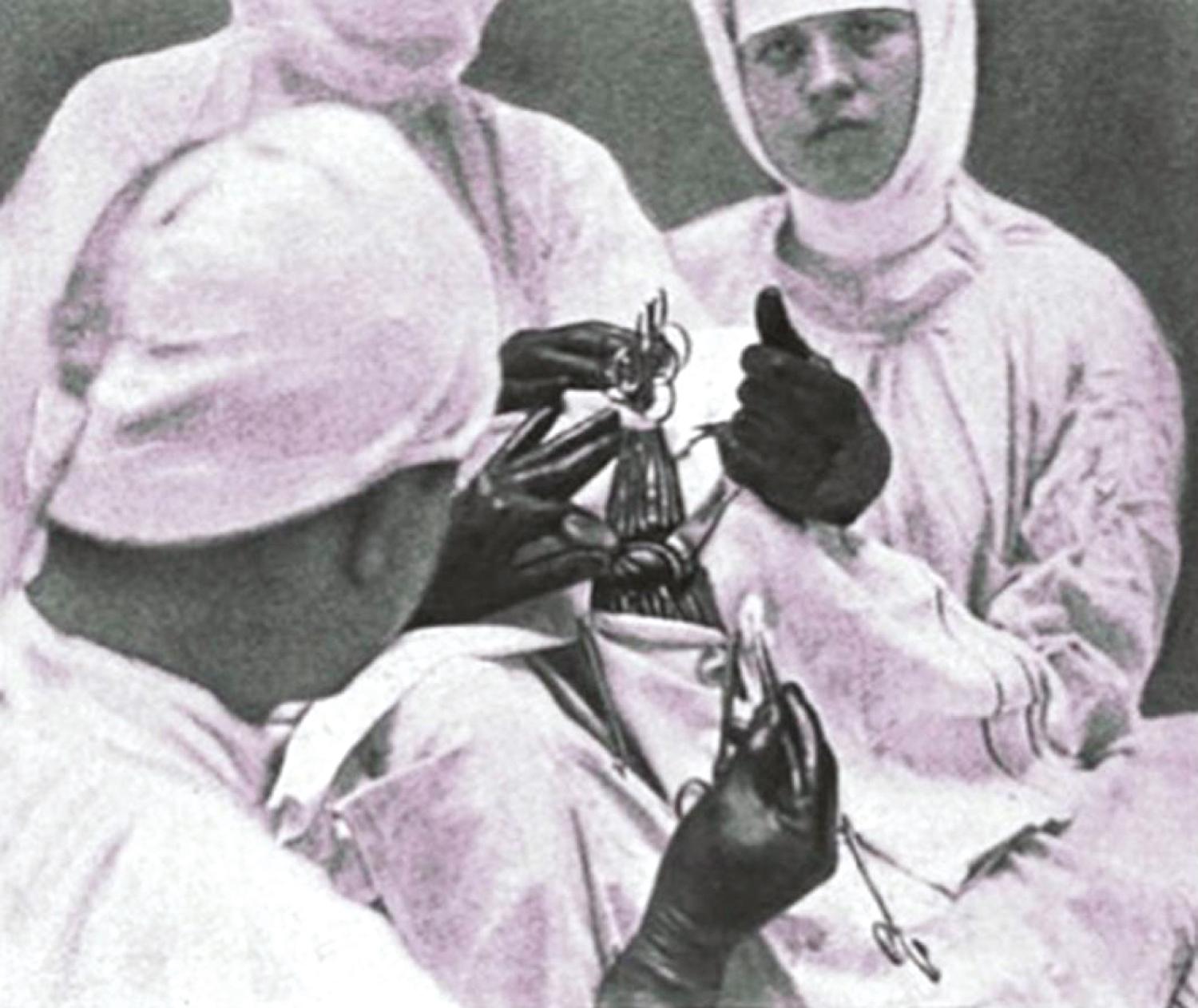 eFigure 33.5, Photograph taken during surgery demonstrating the use of Charles Frazier’s spoon as a brain elevator (held with his left thumb and index finger), while an assistant uses his handheld retractor for greater exposure.