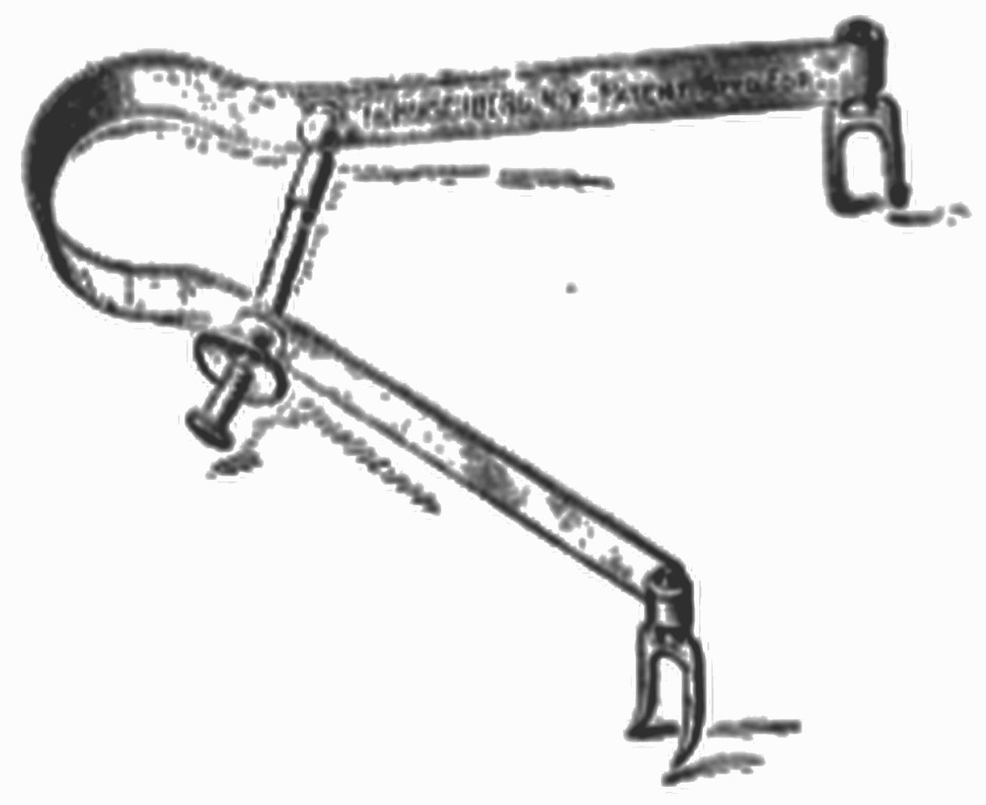 eFigure 33.6, A self-retaining retractor similar to the Broz wound dilator.