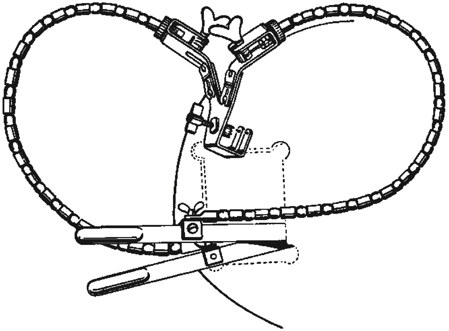 eFigure 33.9, A Leyla-Yaşargil self-retaining retractor.