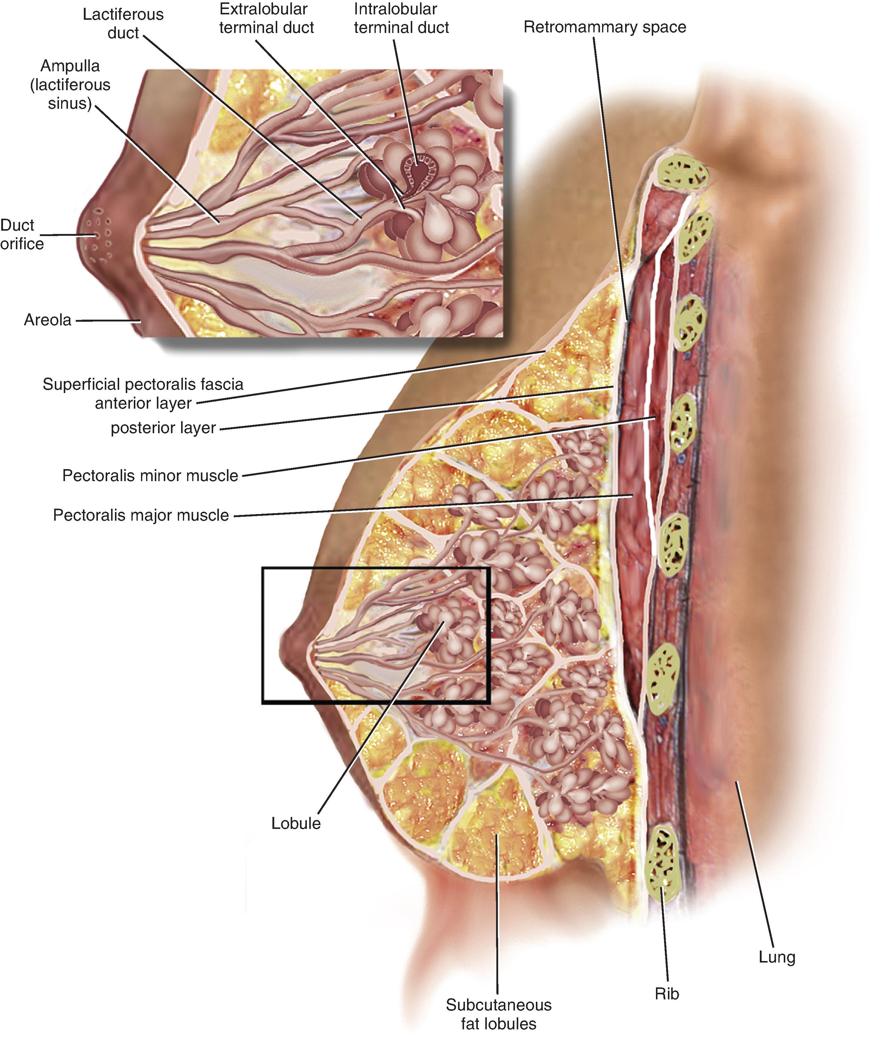 FIG. 1, Anatomy of the mature breast before pregnancy. ( Fr om Stahl DL, Columbus KS, Baggish MS. Anatomy of the female breast. In: Baggish and Karram Atlas of pelvic anatomy and gynecologic surgery . 4th ed. Philadelphia: Elsevier; 2016:1169–1180. )