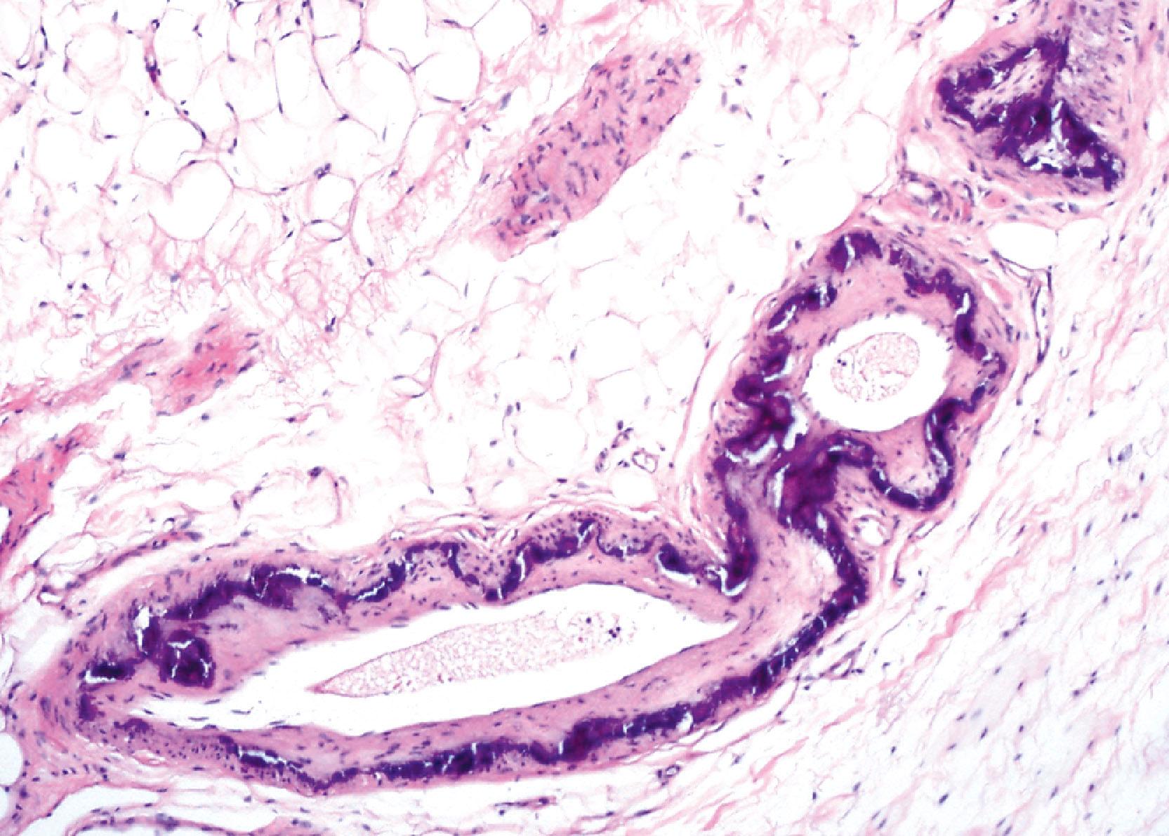 Breast Development, Physiology, and Histology - Clinical Tree