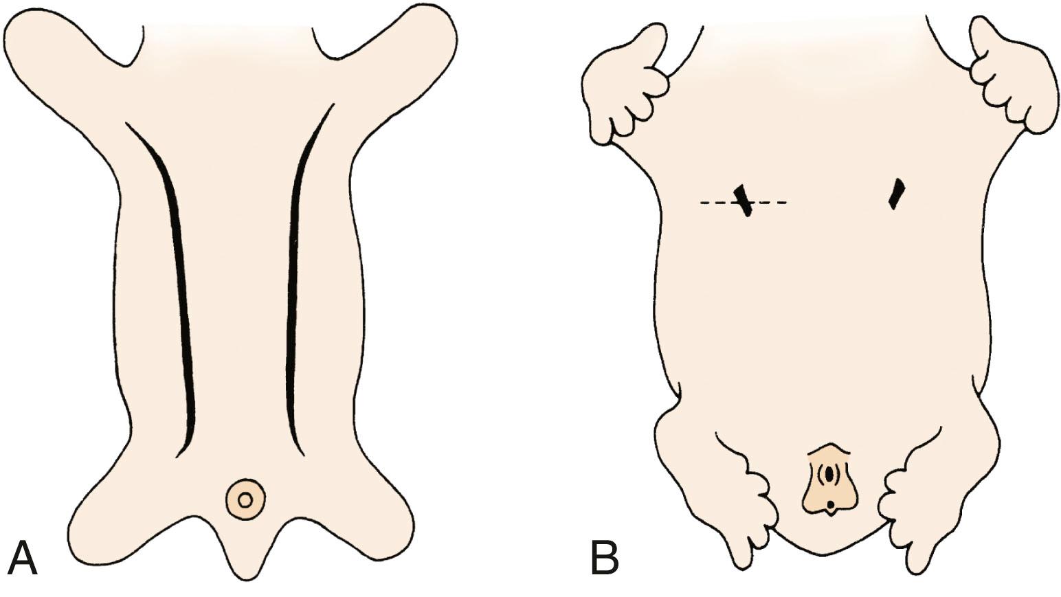 Fig. 5.1, The mammary ridges and their regression. (A) Ventral view of an embryo at the beginning of the fifth week of development (about 28 days), showing the mammary ridges that extend from the forelimb to the hind limb. (B) A similar view of the ventral embryo at the end of the sixth week, showing the remains of the ridges located in the pectoral region.