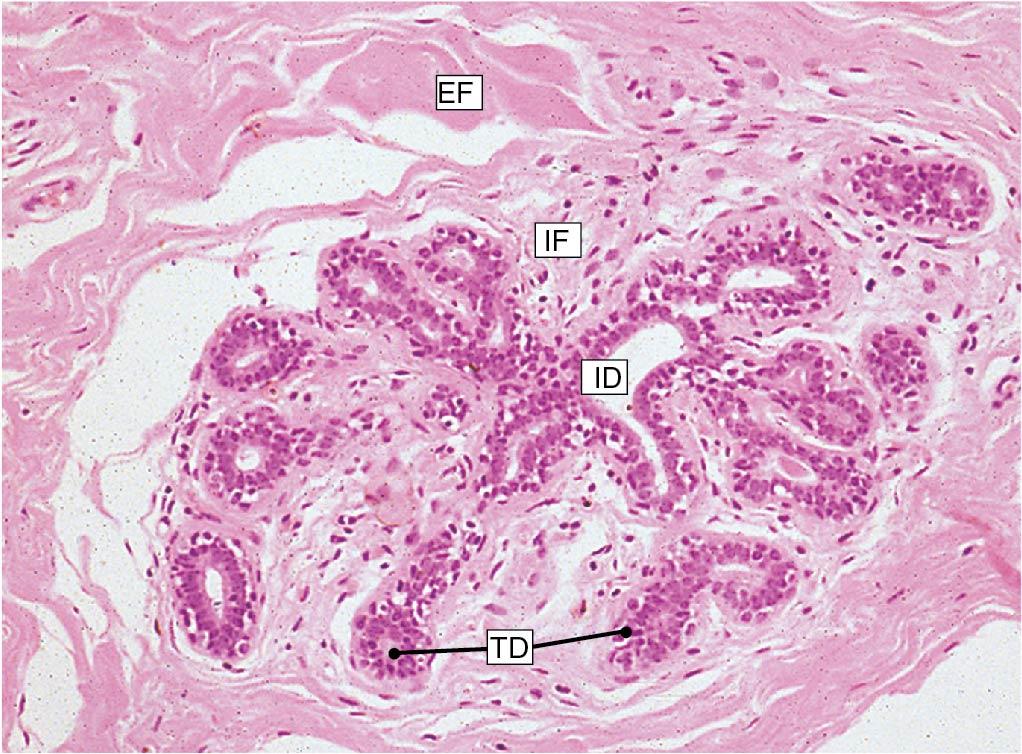 Fig. 15.3, Histologic photograph of a mammary lobule. Note the ductal tissue surrounded by fibrous tissue. Terminal ductules (TD) surround the central ductule (ID). EF, Extralobular fibrocollagenous tissue.