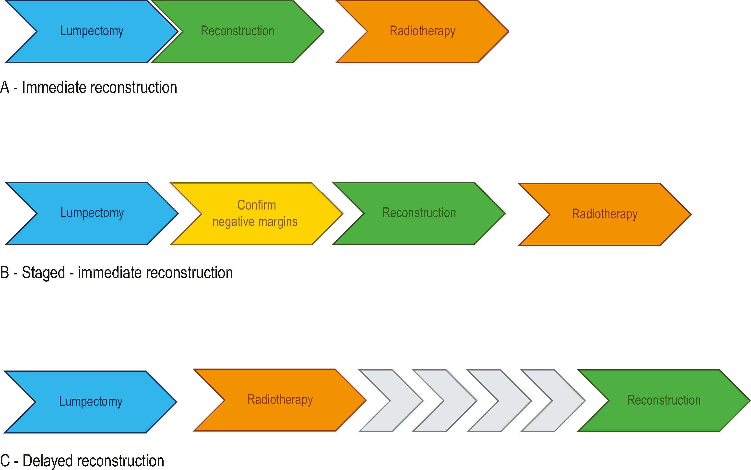 Figure 48.3, Partial BR process in the setting of breast-conserving therapy.