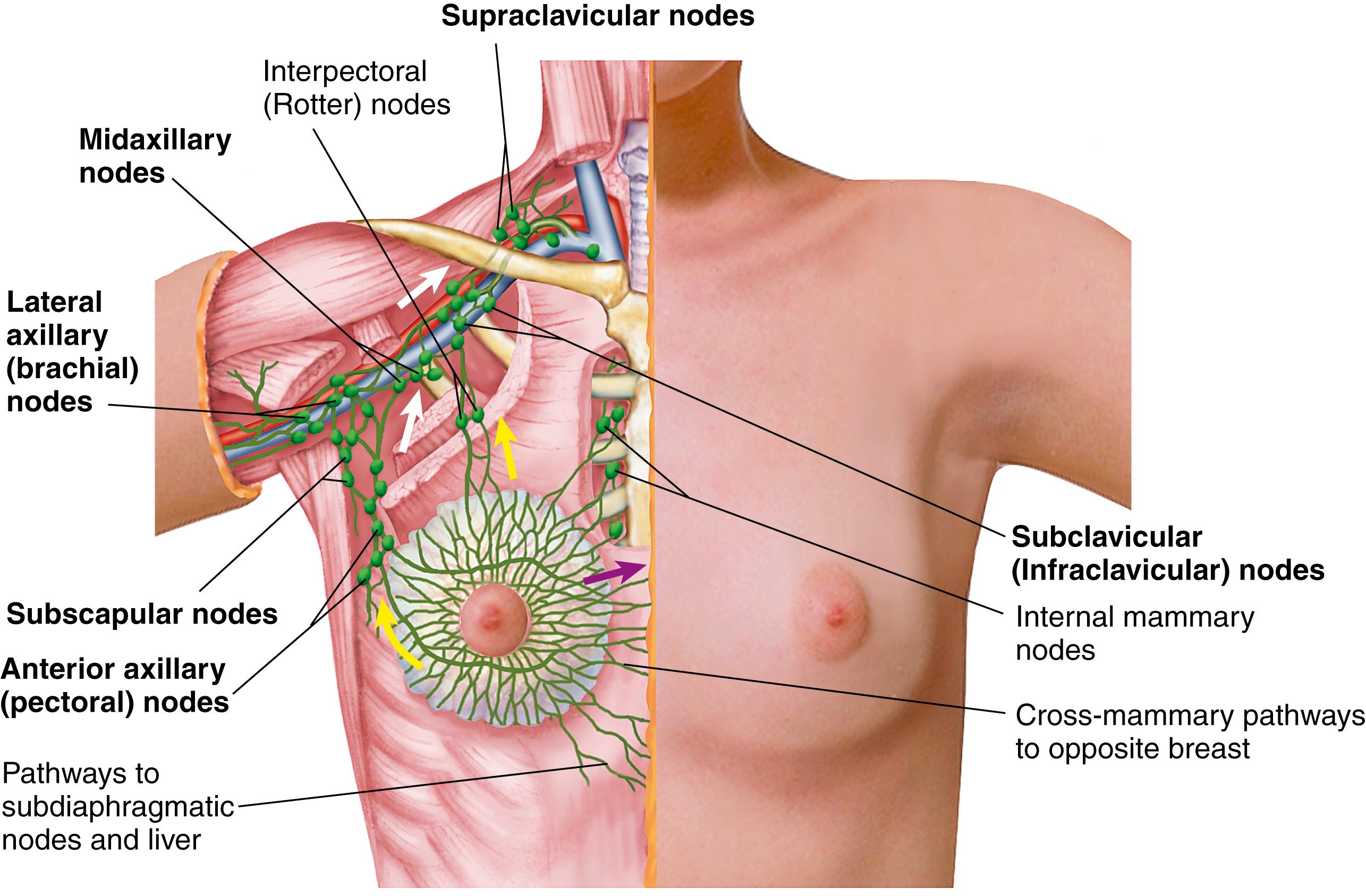 FIG. 17.3, Lymphatic drainage of the breast.