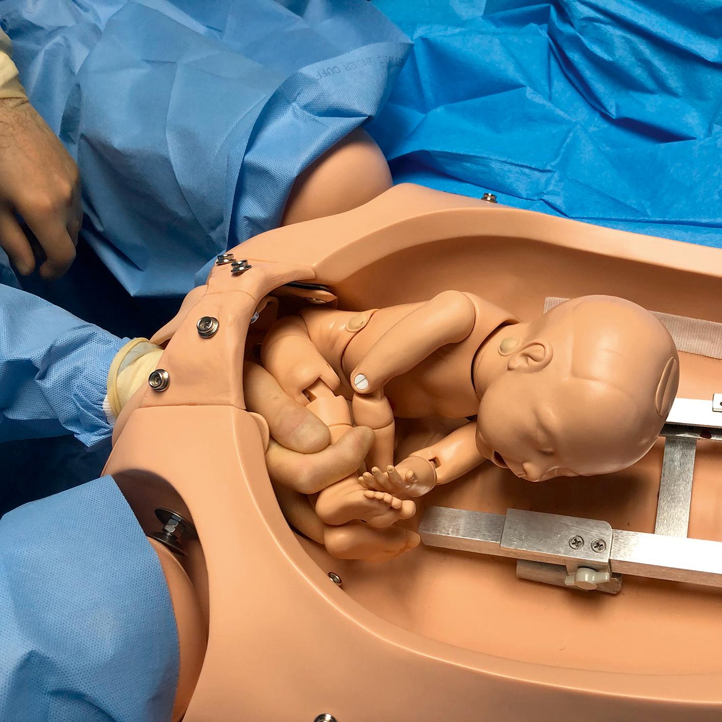 Fig. 12.1, To begin a breech extraction, the provider grasps the baby's feet.