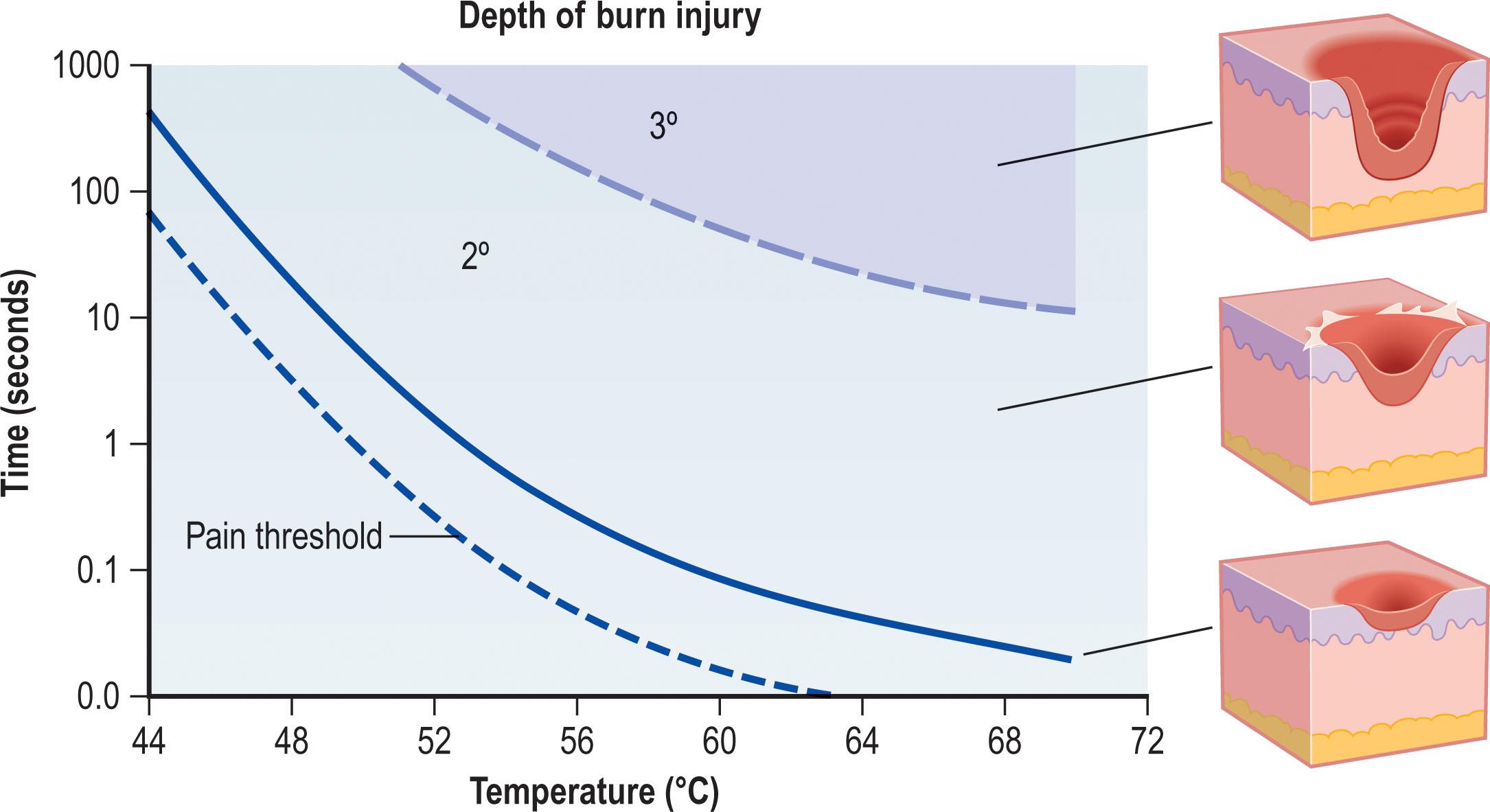 Figure 18.1, The importance of both temperature and time in determining the depth and extent of injury is illustrated by this curve. The threshold for feeling pain precedes injury, and sensation is lost once all cutaneous pain receptors are burned. The data is adapted from various models.