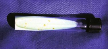 Figure 22-1, Culture of M. ulcerans from a Congolese patient (Bas-Congo province) on Löwenstein-Jensen medium. Note the yellowish pigmentation of the colonies. Pigmentation has been noted to vary with geographic origin.