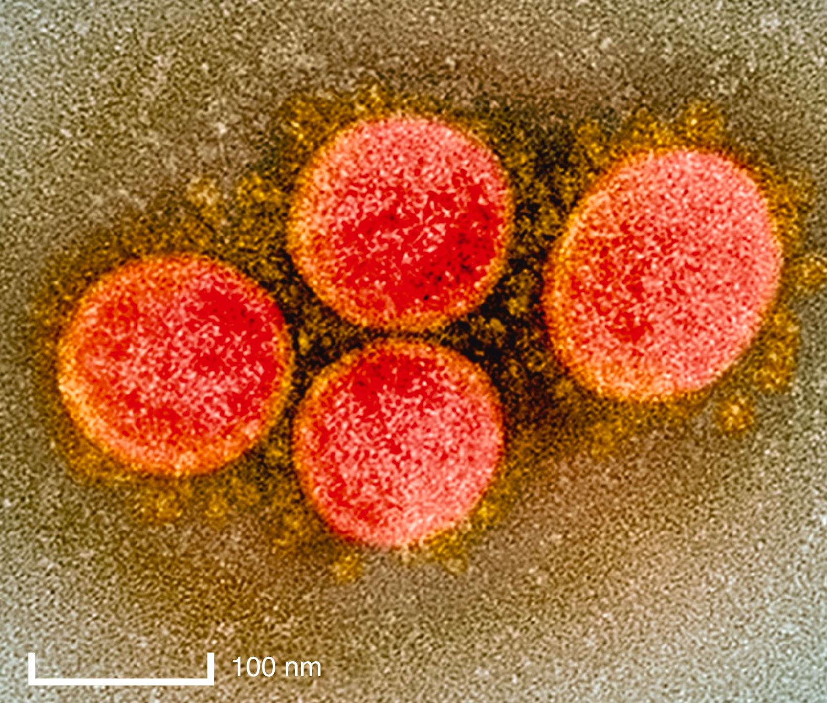 FIGURE 335-1, Transmission electron micrograph of severe acute respiratory syndrome coronavirus-2 (SARS-CoV-2) viral particles isolated from a patient.