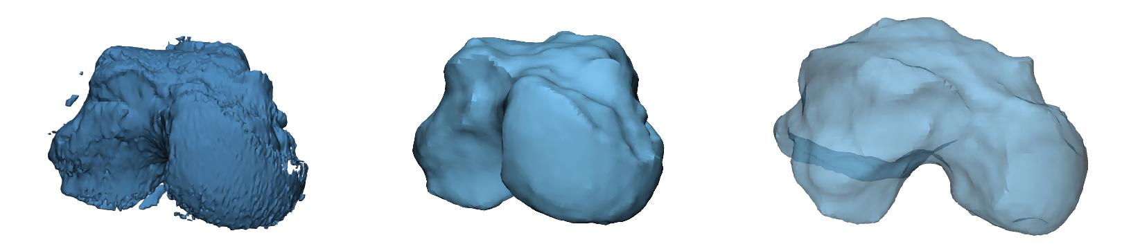 • Fig. 2.3, Pixels for one bone mask visualized in 3D. Extraneous shells and gaps in the outer surface of the model can be easily visualized (left) . The result of wrapping (closing gaps under 3 mm) for the binary mask, converting the point cloud into a surface mesh (middle) . The same mesh shown with transparency to highlight the uniform surface with no internal lesions (right) .