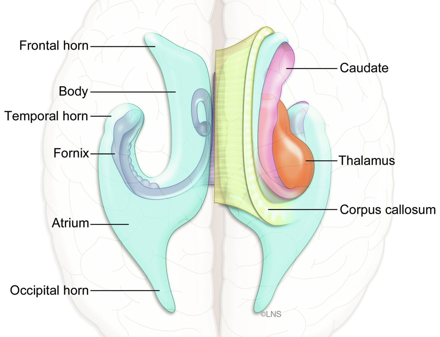 Fig. 33.1, Neuroanatomy of the periventricular region. The major neural structures are shaped in an inward and anteriorly tilted “C” centered around the thalamus. Although these deep structures serve a range of high-level functions, they are considered noneloquent.