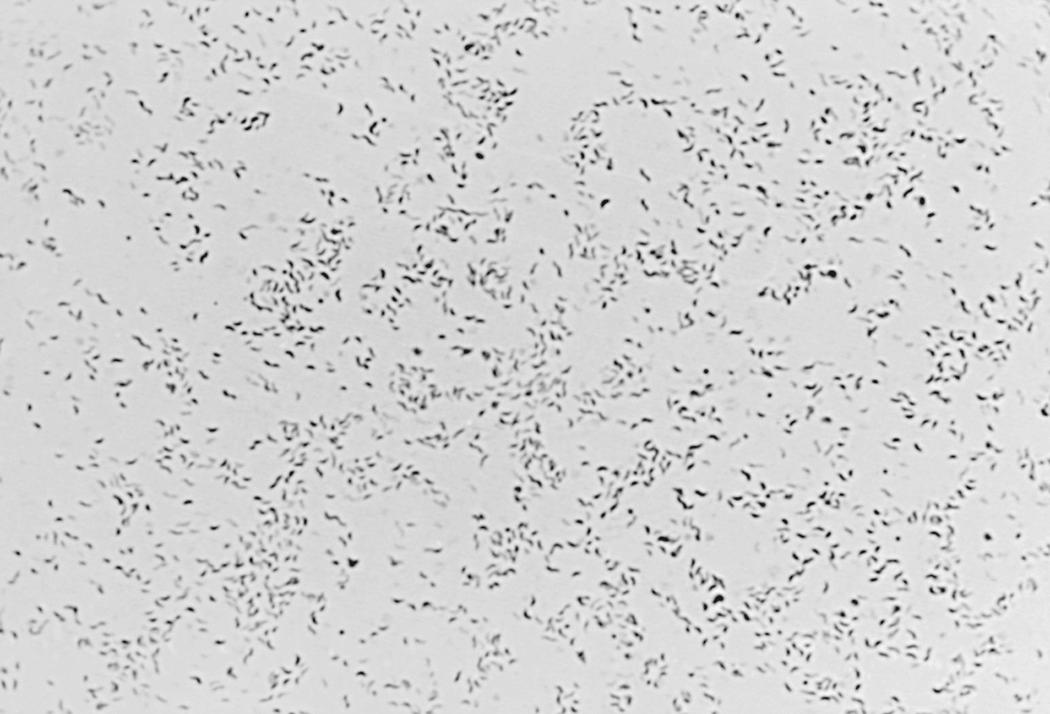 FIG. 216.1, Fine-curved, S -shaped, or spiral, lightly staining gram-negative appearance of Campylobacter jejuni in pure culture (×1000).