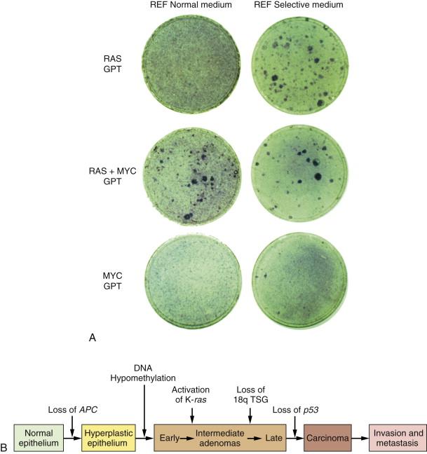 Figure 1-4, Multistep tumorigenesis in vitro and in vivo