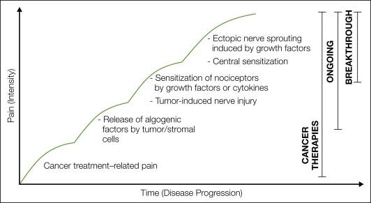 Figure 72-1, An evolving set of mechanisms drives cancer pain.