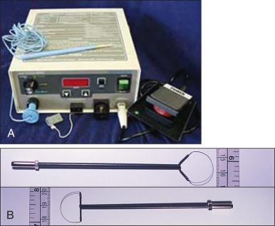 Figure 84.8, Equipment used for loop electrosurgical excision procedures (loop electrodiathermy excision procedure [LEEP]). (A) LEEP system 6000 (Cooper Surgical). (B) Large loop electrodes used for LEEP.