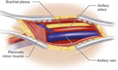 Figure 2.3