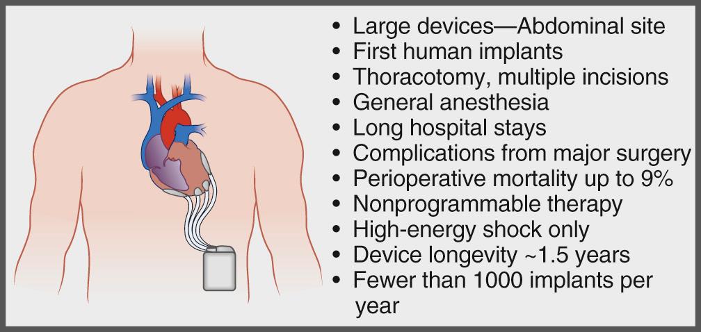 FIGURE 85-1, Implantable cardioverter-defibrillators in 1980.