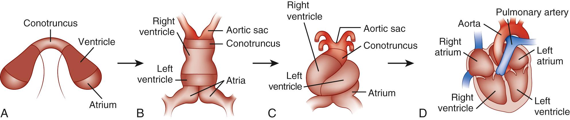 FIGURE 104-1, Model of cardiogenesis. Cardiogenic precursors bilaterally positioned in the lateral plate mesoderm contain prepatterned information regarding their ultimate positional identity and cell fate, as modeled by color code (A). The convergence and fusion of the cardiac primordia form a linear heart tube (B), which undergoes rightward or D looping (C). Rightward looping appropriately aligns the cardiac chambers for morphogenesis into the mature four-chambered structure (D).