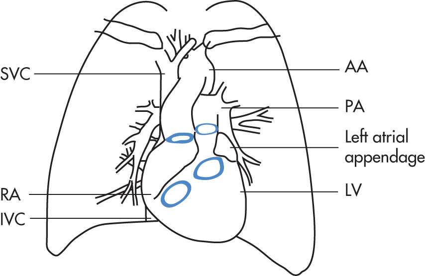 FIG. 2.1