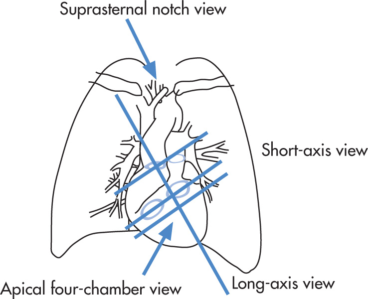 FIG. 2.14