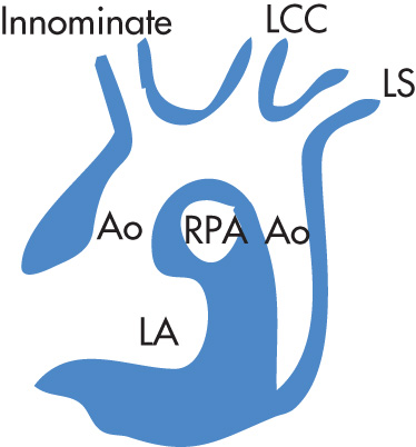 FIG. 2.18