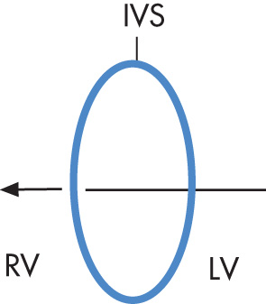 FIG. 2.22