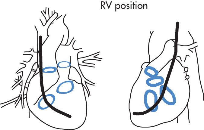 FIG. 2.4