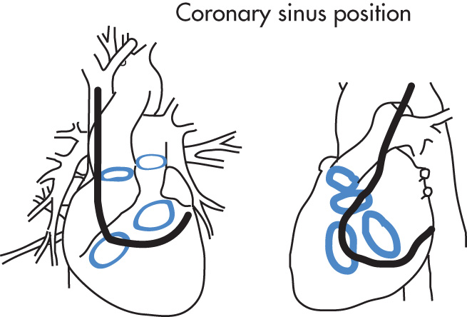 FIG. 2.5