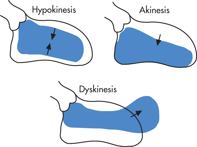 FIG. 2.7