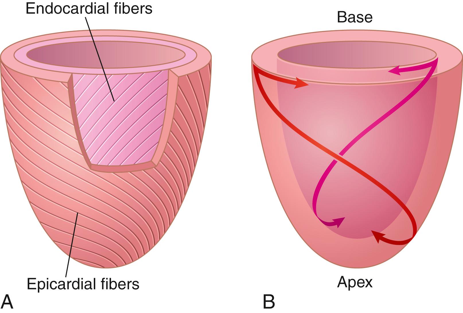 Figure 9-3., A , The left ventricular inner subendocardial fibers ( lavender shade ) run obliquely to the outer subepicardial fibers ( red shade ) . B , The subepicardial muscle fibers are wrapped in a left-handed helix and subendocardial fibers are arranged in a right-handed helix.