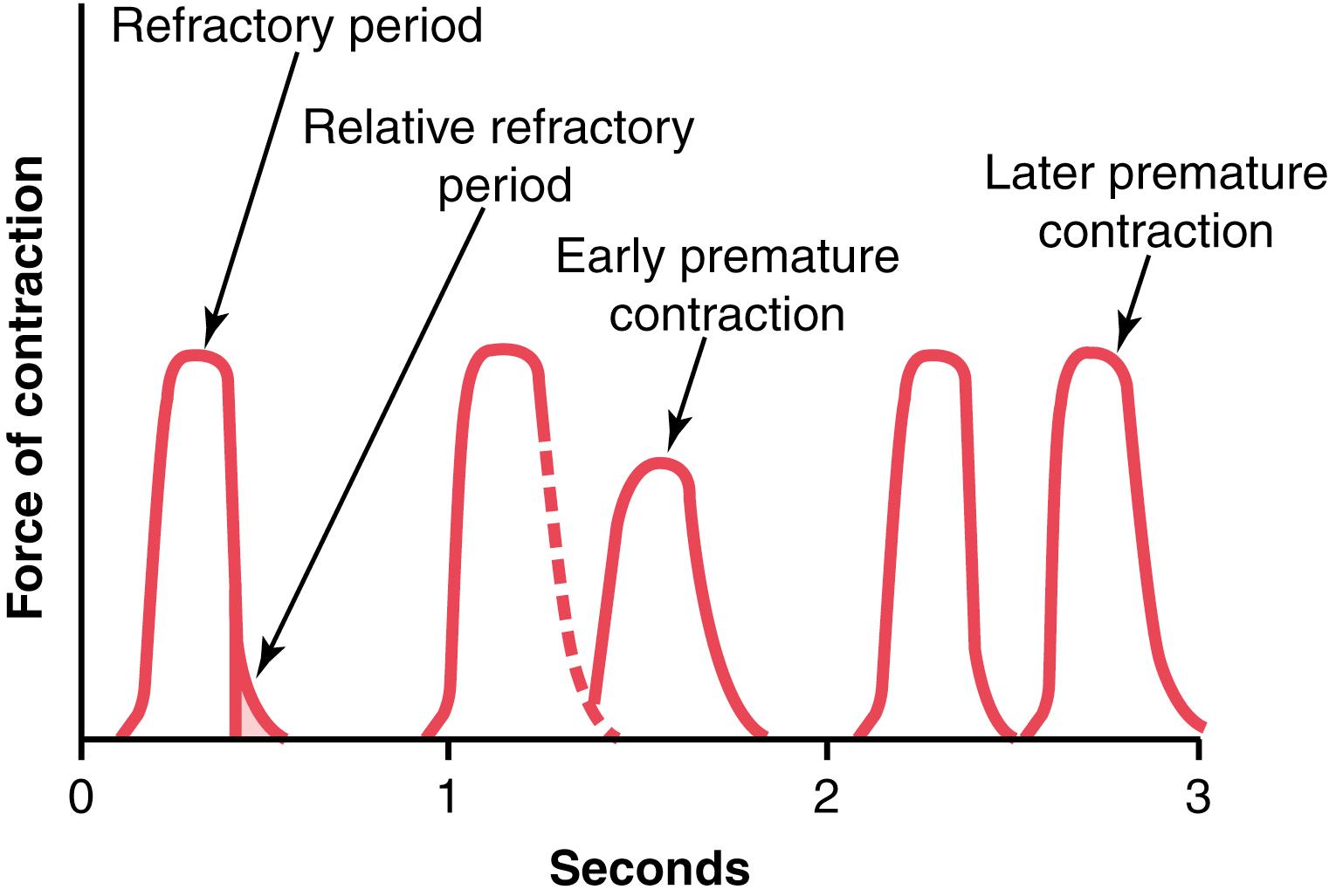 Figure 9-6., Force of ventricular heart muscle contraction, showing also the duration of the refractory period and relative refractory period, plus the effect of premature contraction. Note that premature contractions do not cause wave summation, as occurs in skeletal muscle.