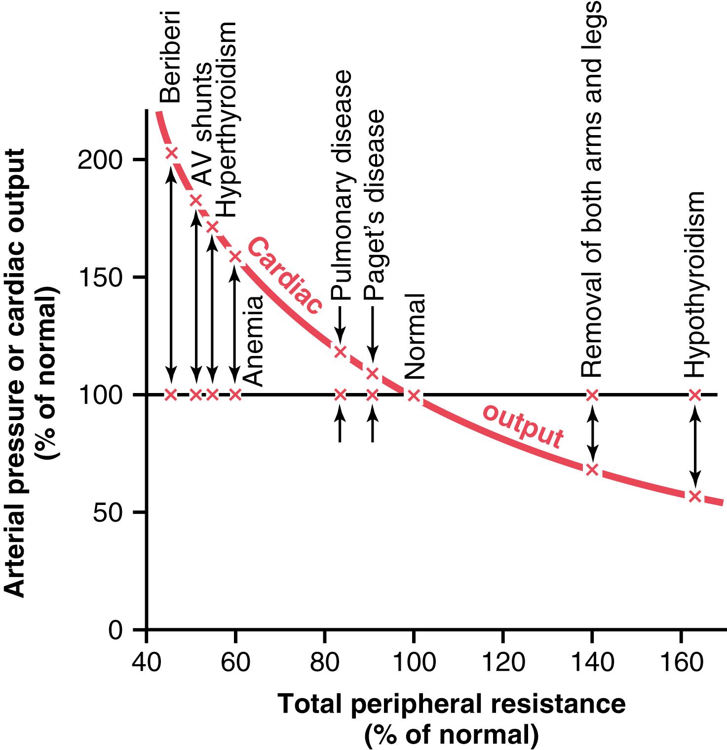 Figure 20-4., Chronic effect of different levels of total peripheral resistance on cardiac output, showing a reciprocal relationship between total peripheral resistance and cardiac output. AV, Atrioventricular.