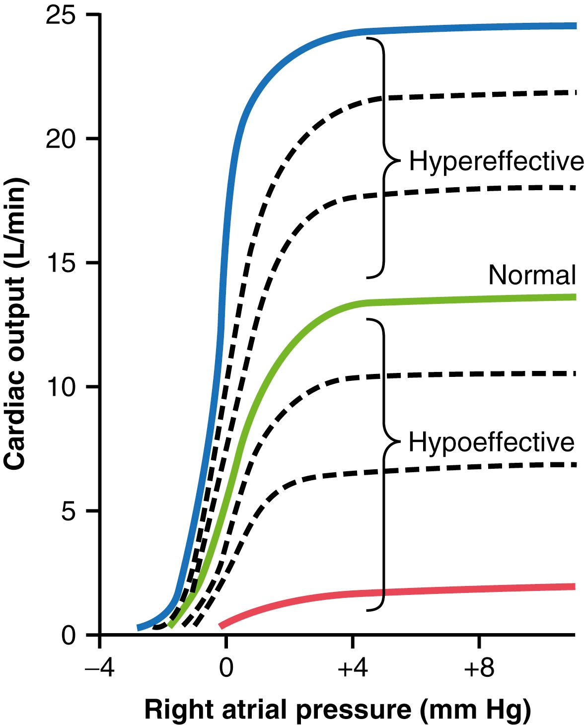 Figure 20-5., Cardiac output curves for the normal heart and for hypoeffective and hypereffective hearts.