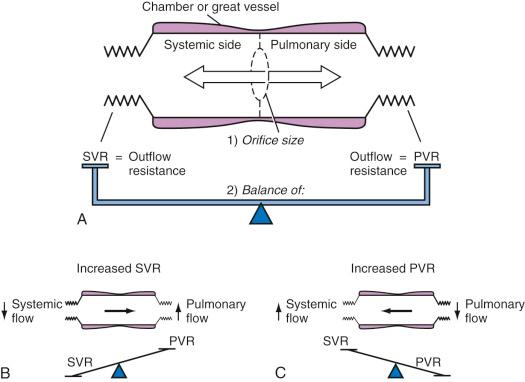 FIGURE 18.7, Influence of orifice size and the ratio of pulmonary vascular resistance (PVR) to systemic vascular resistance (SVR) on the magnitude and direction of a simple shunt. A, PVR and SVR are balanced, resulting in equal pulmonary and systemic blood flows. B, PVR is reduced relative to SVR, resulting in an increase in pulmonary blood flow and a decrease in systemic blood flow. C, PVR is elevated relative to SVR, resulting in a decrease in pulmonary blood flow and an increase in systemic blood flow.