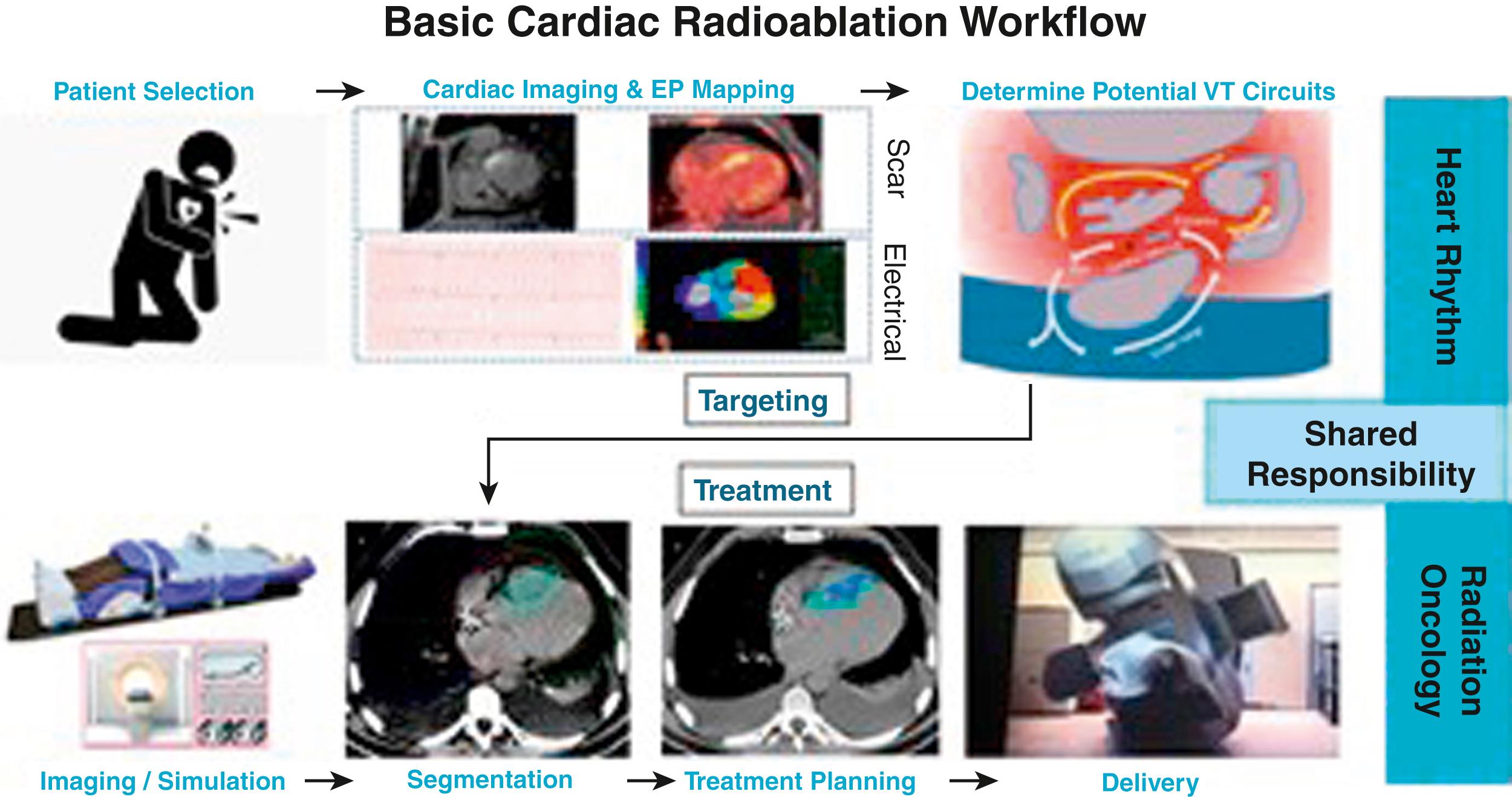 Fig. 133.2, Cardiac radioablation workflow.