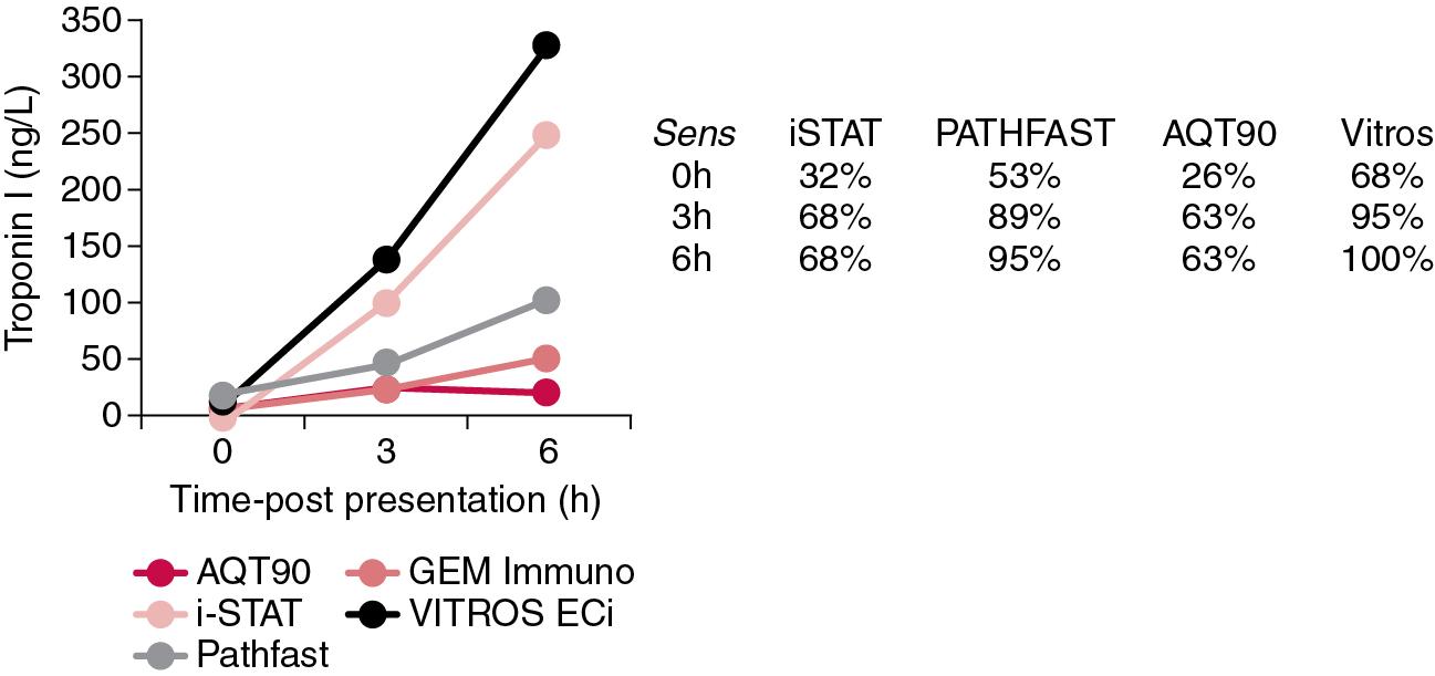 FIGURE 48.14, Serial cTnI findings for a representative myocardial infarction patient plotted as a function of time (hours) versus cTnI concentration for 5 cTnI assays; respective clinical sensitivities shown at baseline for assays.
