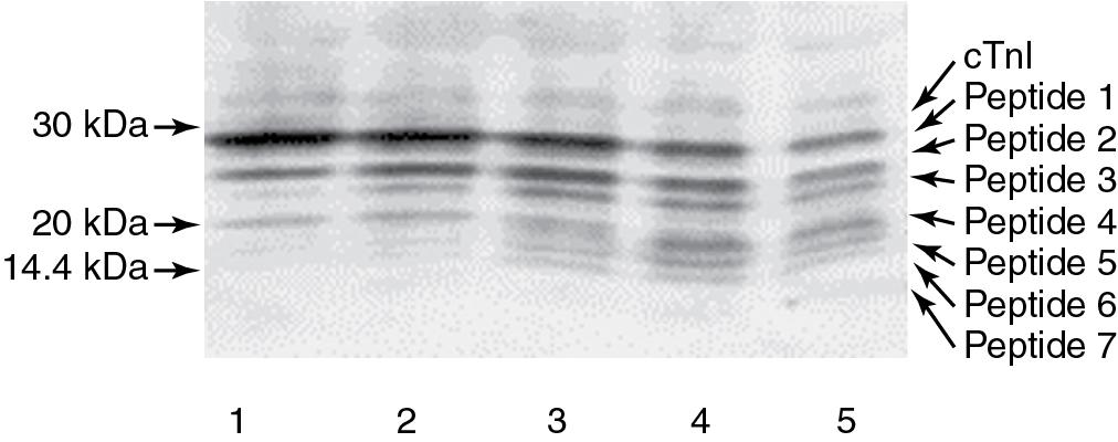 FIGURE 48.7, Western blot analysis of endogenous cardiac troponin I (cTnI) proteolysis in human heart tissue visualized with monoclonal anti-cTnI antibody. Protein extracts from tissue samples were incubated at 37 °C for 0 hour (lane 1), 2 hours (lane 2), 5 hours (lane 3), 8 hours (lane 4), and 20 hours (lane 5), separated by 10 to 20% gradient sodium dodecyl sulfate (SDS)-gel electrophoresis, transferred to a nitrocellulose membrane, and visualized by MAb 19C7. The apparent molecular masses and peptides are marked by arrows.