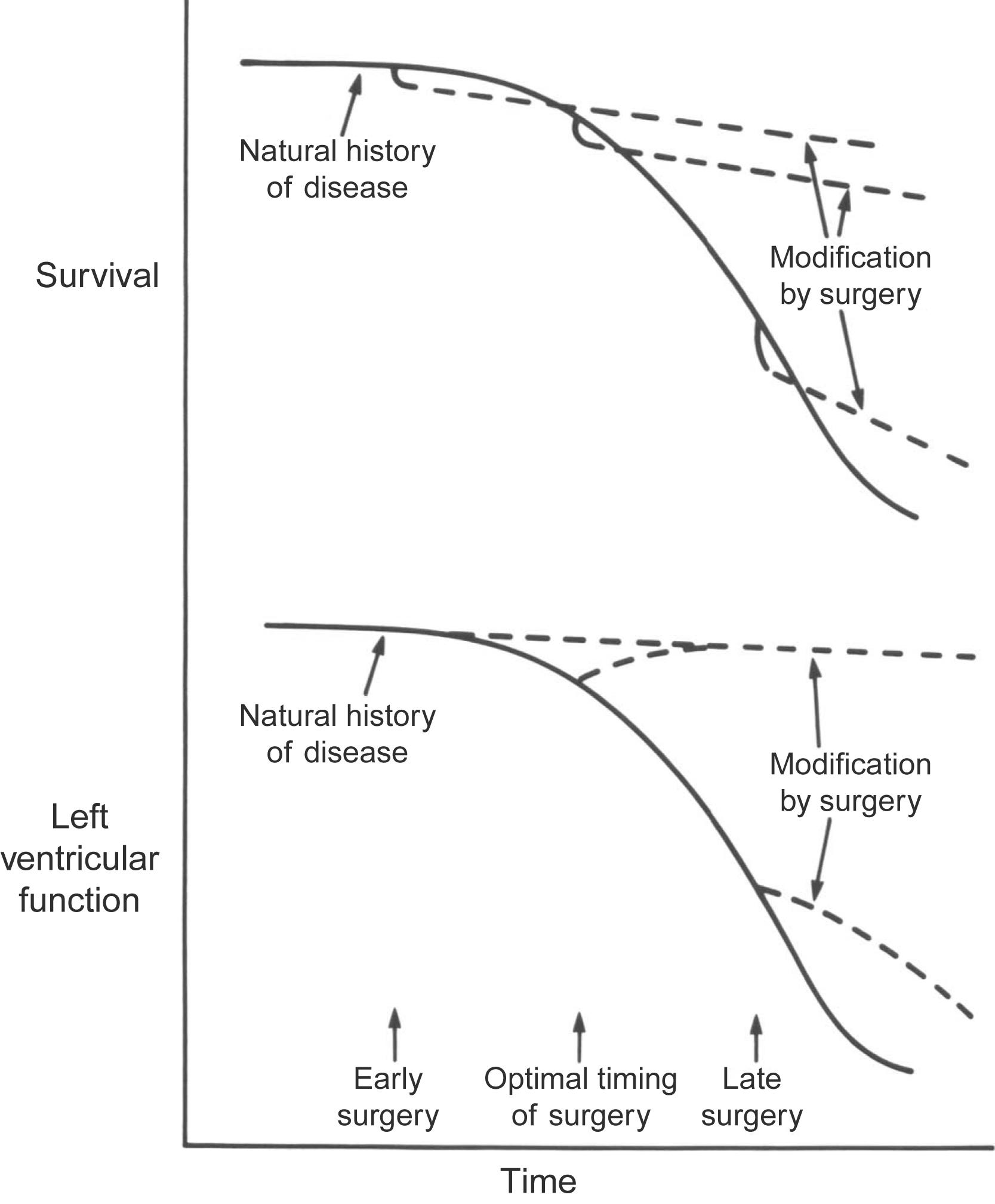 Figure 17.1, Schematic representation of the concept of optimal timing of valve replacement surgery. Early surgery has low operative mortality and preserves ventricular function. However, because of potential prosthesis-associated complications, postoperative risk exceeds that of pure medical treatment at this early phase of the disease. In contrast, if surgery is done too late, operative mortality is increased and ventricular function is more likely to deteriorate after surgery. Thus following late surgery, postoperative survival is primarily determined by both prosthesis-associated complications and congestive heart failure. Optimal timing of surgery balances the risks of maintained medical management with the new risks associated with postoperative complications: operative mortality is relatively low, ventricular function is almost completely preserved, and postoperative risk is determined, as in early surgery, predominantly by the risk of prosthesis-associated complications.