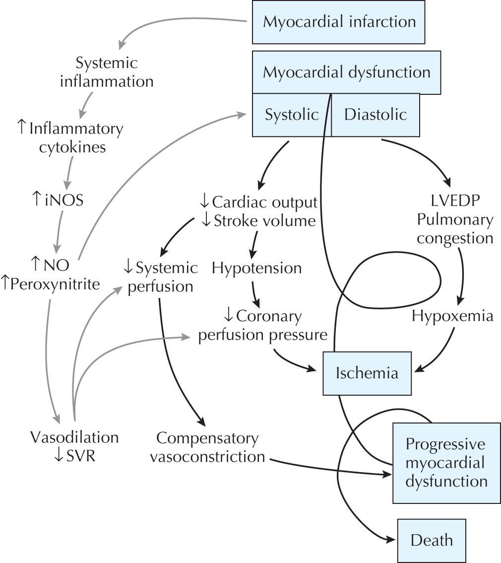 FIG 24.1, Classic Paradigm of Cardiogenic Shock With Recent Observation That Inflammatory Mediators Contribute to a Vicious Cycle of Hypotension and Further Ischemia.