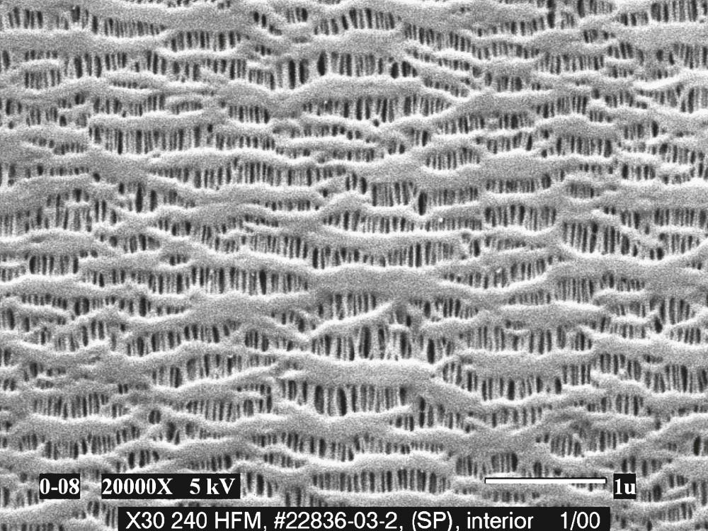 FIGURE 63-3, Scanning electron micrograph of a microporous membrane (Celgard) used in a membrane oxygenator (×20,000).