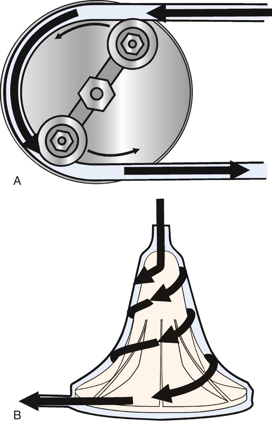 FIGURE 63-7, A, A double roller pump has rotating arms oriented at 180 degrees like spokes on a wheel. Spool-shaped rollers are located at the ends of the arms. A length of tubing is locked inside a curved track at the outer circumference of a partial circle of 210 degrees. B, A typical centrifugal pump has a cone-shaped outer housing with an upper inlet and a single lower outlet. The inner chamber contains spinning concentric smooth cones or fins, mounted on a central impeller. Arrows indicate direction of blood flow.