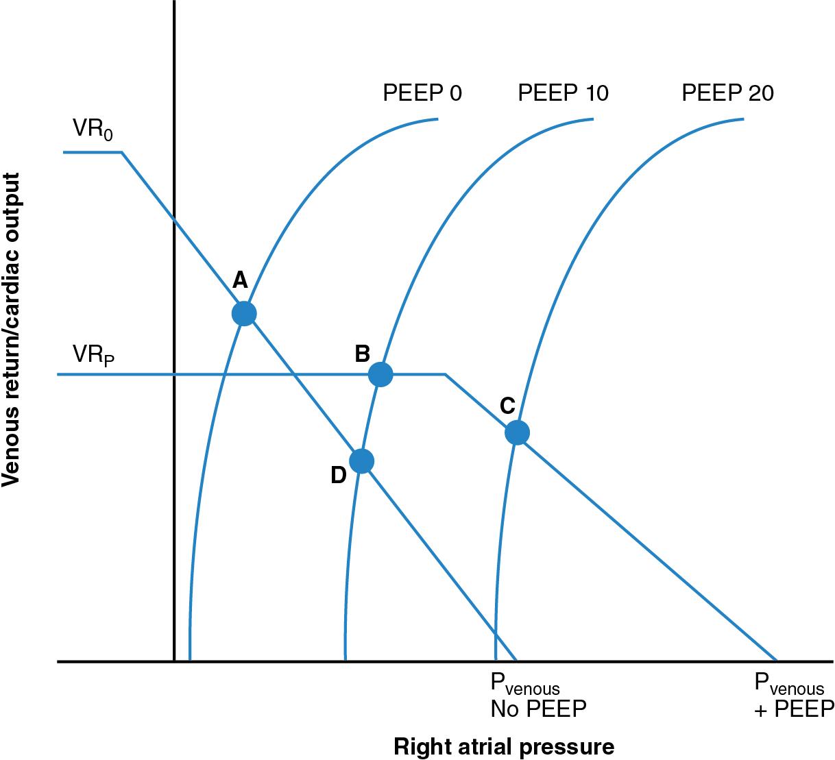 Fig. 4.2, Relationship between cardiac function and venous return curves illustrating the hemodynamic effects of positive end-expiratory pressure (PEEP).