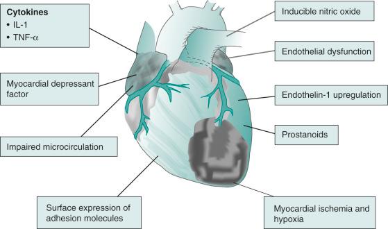 FIGURE 115.1, Pathogenesis of cardiac dysfunction in sepsis.