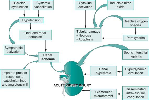 FIGURE 115.2, Pathogenesis of acute kidney injury in sepsis.