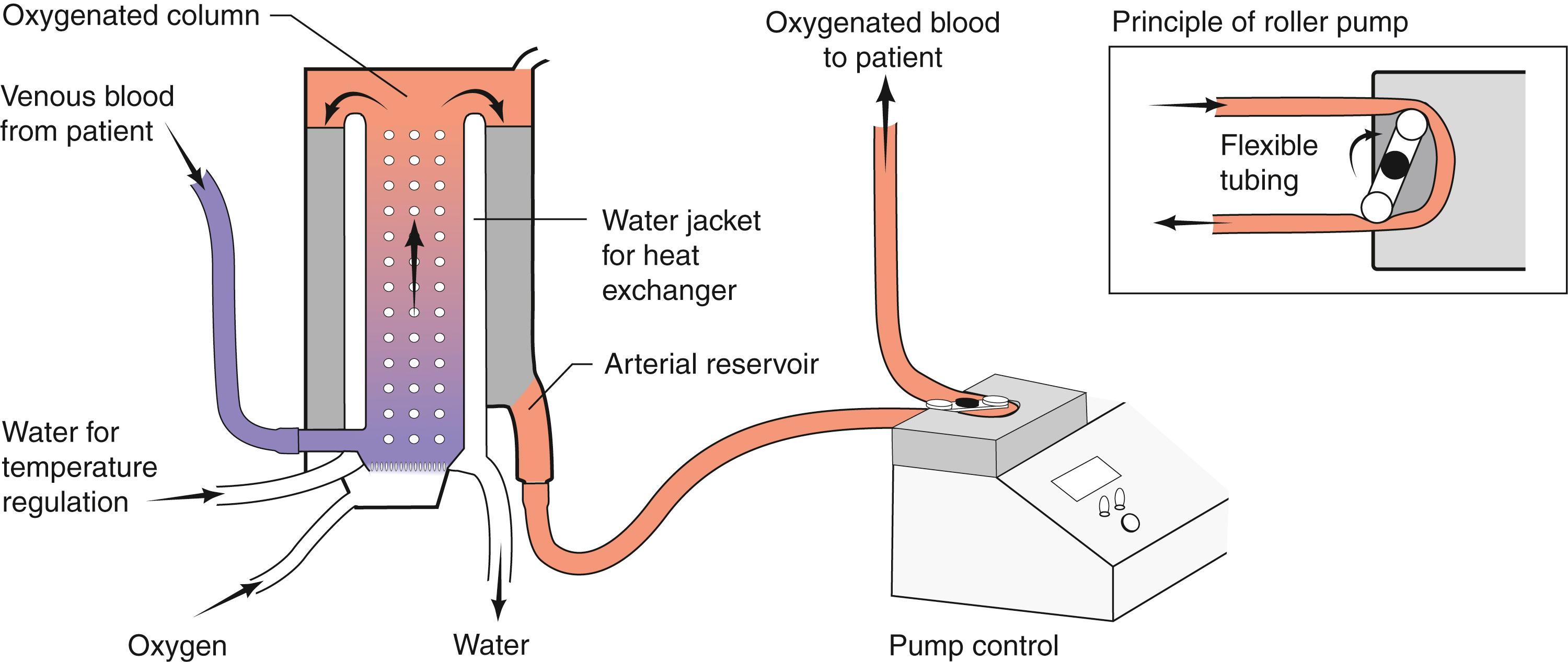 Fig. 23.2, Schematic of a bypass circuit.