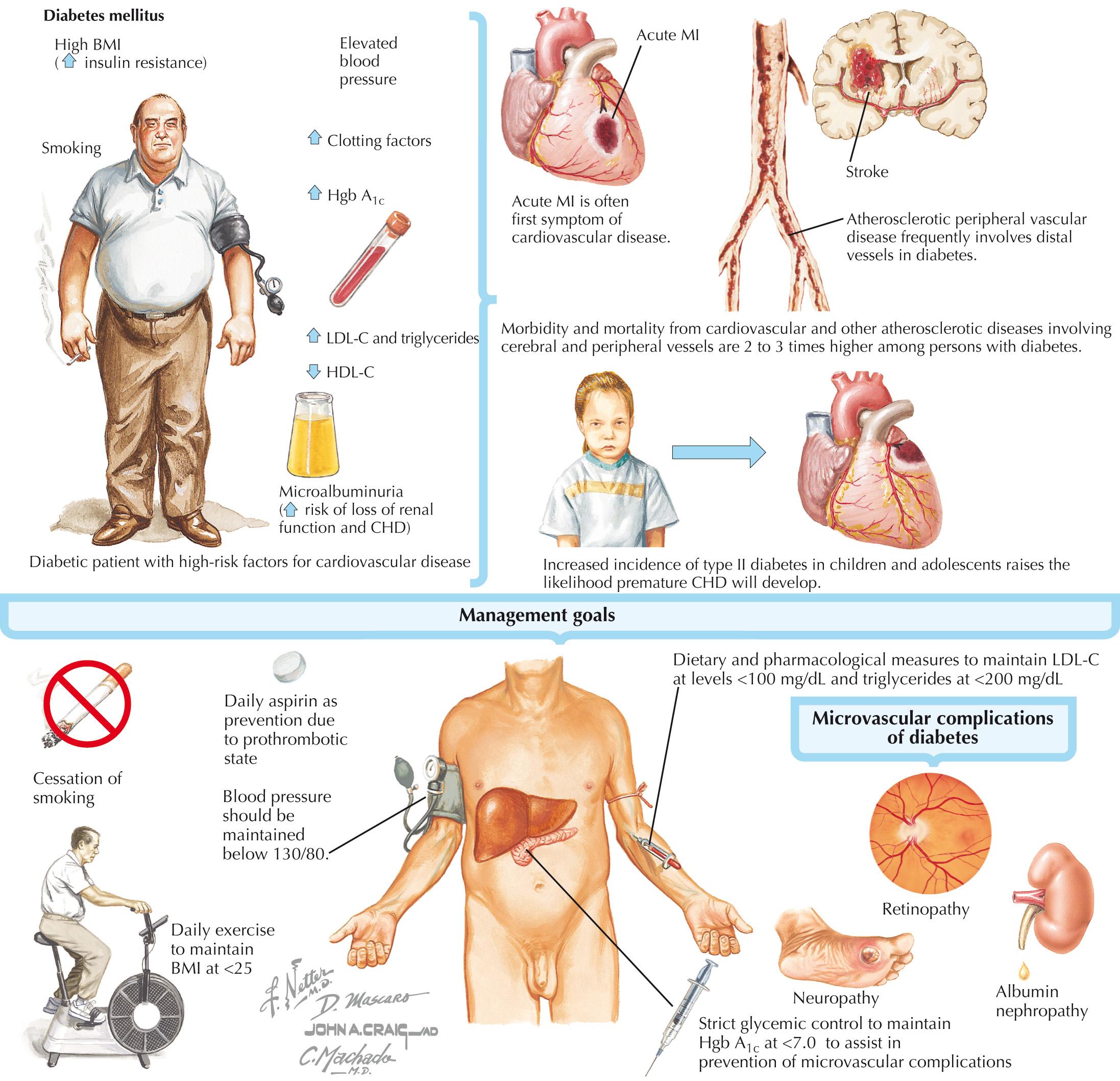 FIG 72.1, Cardiovascular Disease in Diabetes.